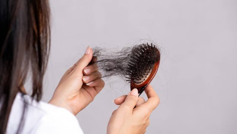 ریزمغذی‌های مفید برای جلوگیری از ریزش مو