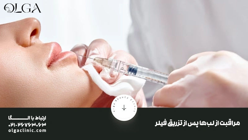 مراقبت های بعد از فیلر لب شامل چه مواردی است؟